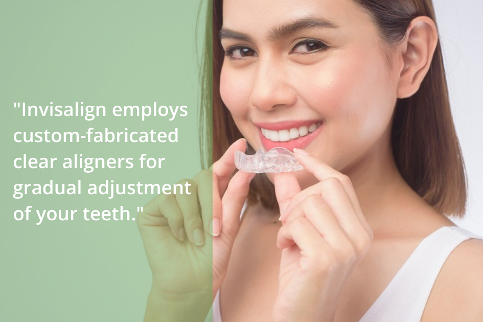 Invisalign utilizes custom-fitted clear aligners for the advancement of your straight teeth.