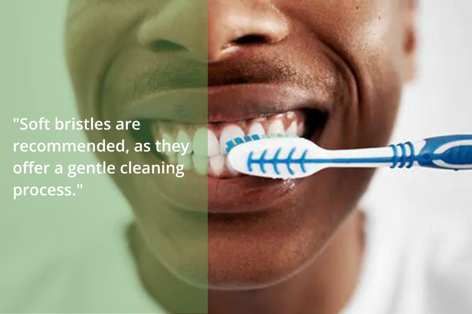 Tips: Soft toothbrushes are recommended for a gentle cleaning process to meet your dental needs.