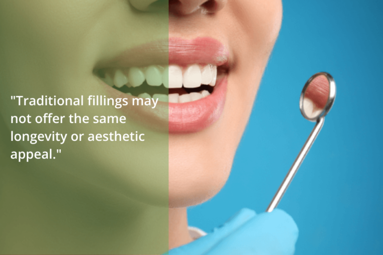 Porcelain Inlays and Onlays vs. Traditional Fillings Which Is Better? Cedar Park Premier
