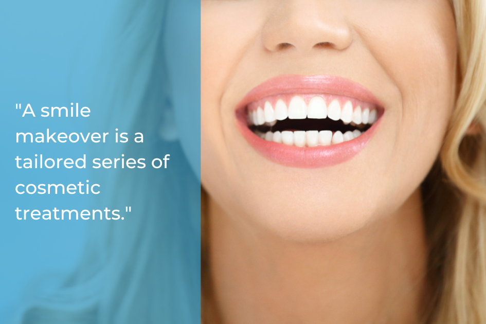 Close-up of a woman's smile with white teeth, next to the text: "A smile makeover is a tailored series of cosmetic dentistry treatments.